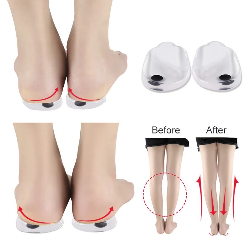 

Magnetic Massage Insoles Gel O/x Type Leg Orthotics Heel Pads Corrective Valgus Varus Foot Magnet Massage Insoles Insert Pads
