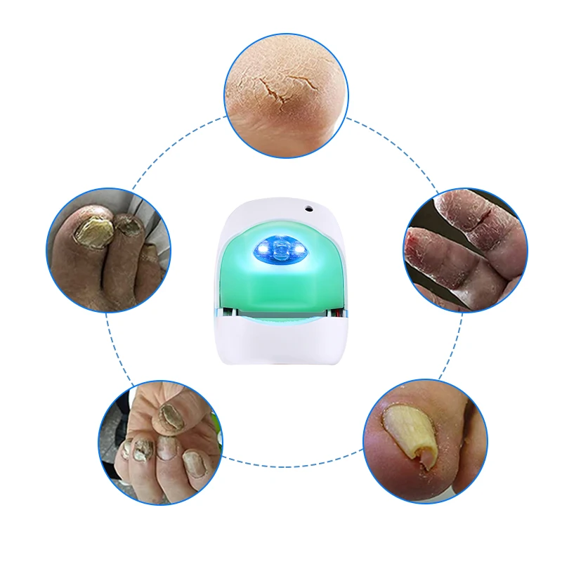 Atang – dispositif Portable pour les ongles, traitement des champignons, Infection au Laser, couleur grise