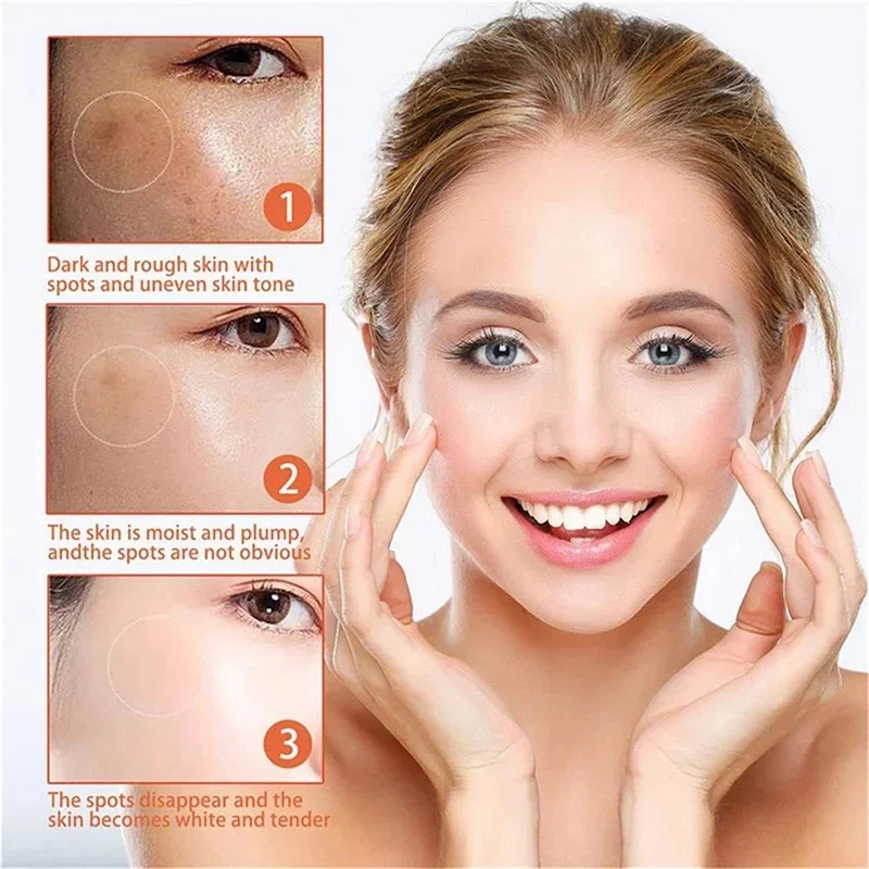 Crema iluminadora facial, suero para el cuidado de la piel oscura, niacinamida, Reduce el Chloasma, Melasma, melanina, desvanece las líneas finas, aclara la piel