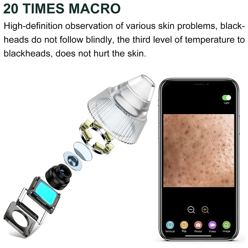 AOKO Blackhead Remover Pore Vacuum  Camera Pore Cleaner Acne Remover Electric Heating Nose Face Deep Cleansing WIFI Microscope