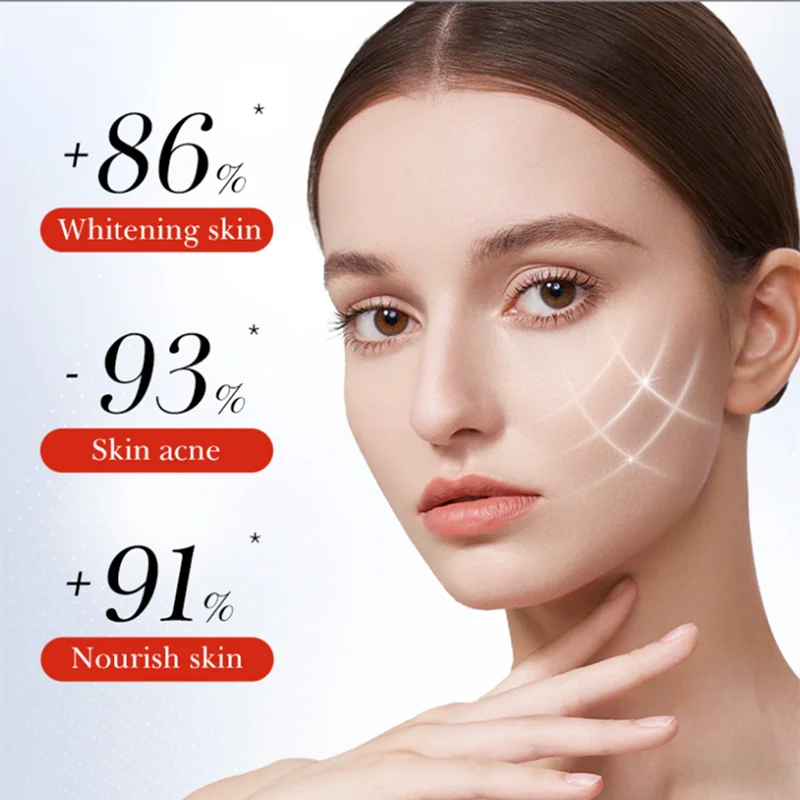 30G Whitening Freckle Cream  Kojic Acid Dark Spot Remover Skin Care Moisturizing Brighten Anti-aging Fade Spot Face Beauty