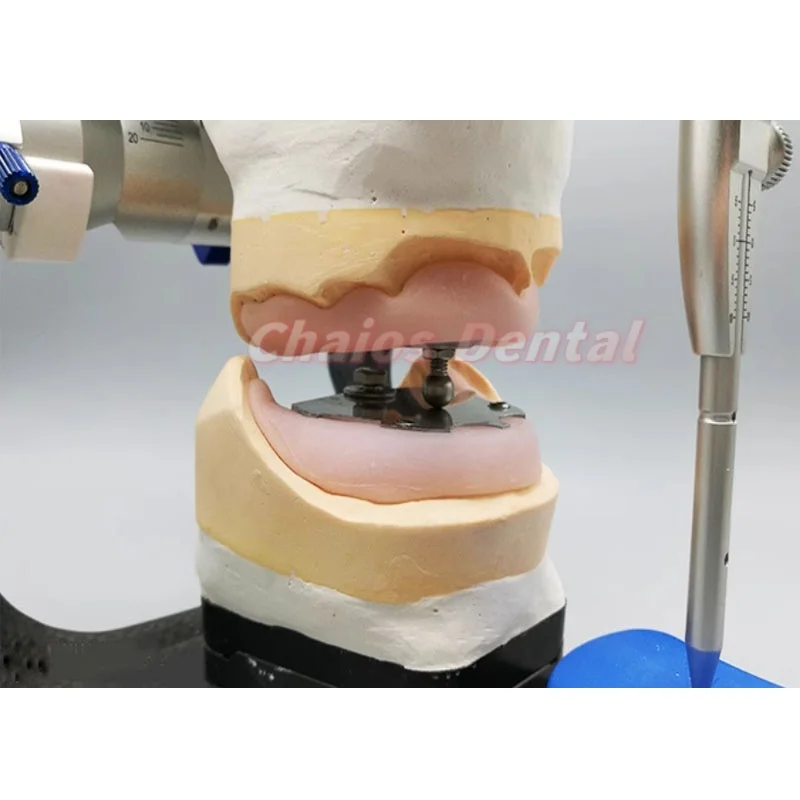 1 ชุดทันตกรรม Gothic Arch Intraoral Registration Jawrecorder Gnathometer Centrofix ชุด Artex Articulator อุปกรณ์เสริม