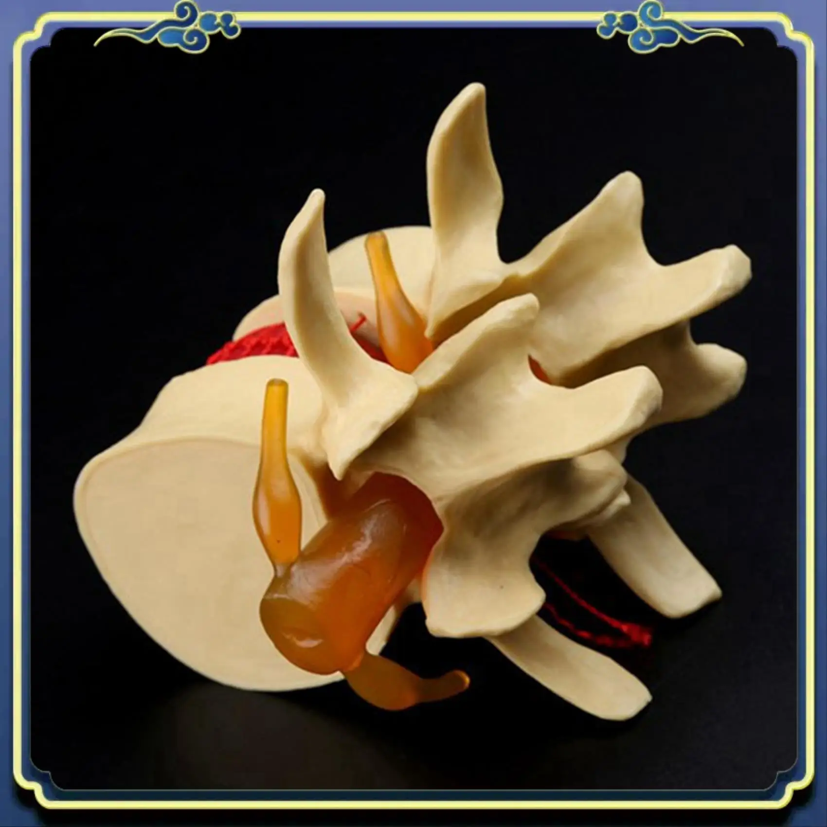 Portable 2X Lumbar Vertebrae Model Anatomical Spine Lumbar Disc Herniation Anatomy Teaching Tool Lumbar Vertebrae Model