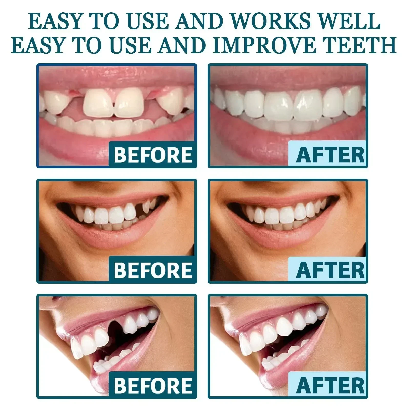 Adjustable Snap-On Dentures - Temporary Dental Repair Kit for Gap Filling & Teeth Alignment, Comfort Fit for Missing Teeth