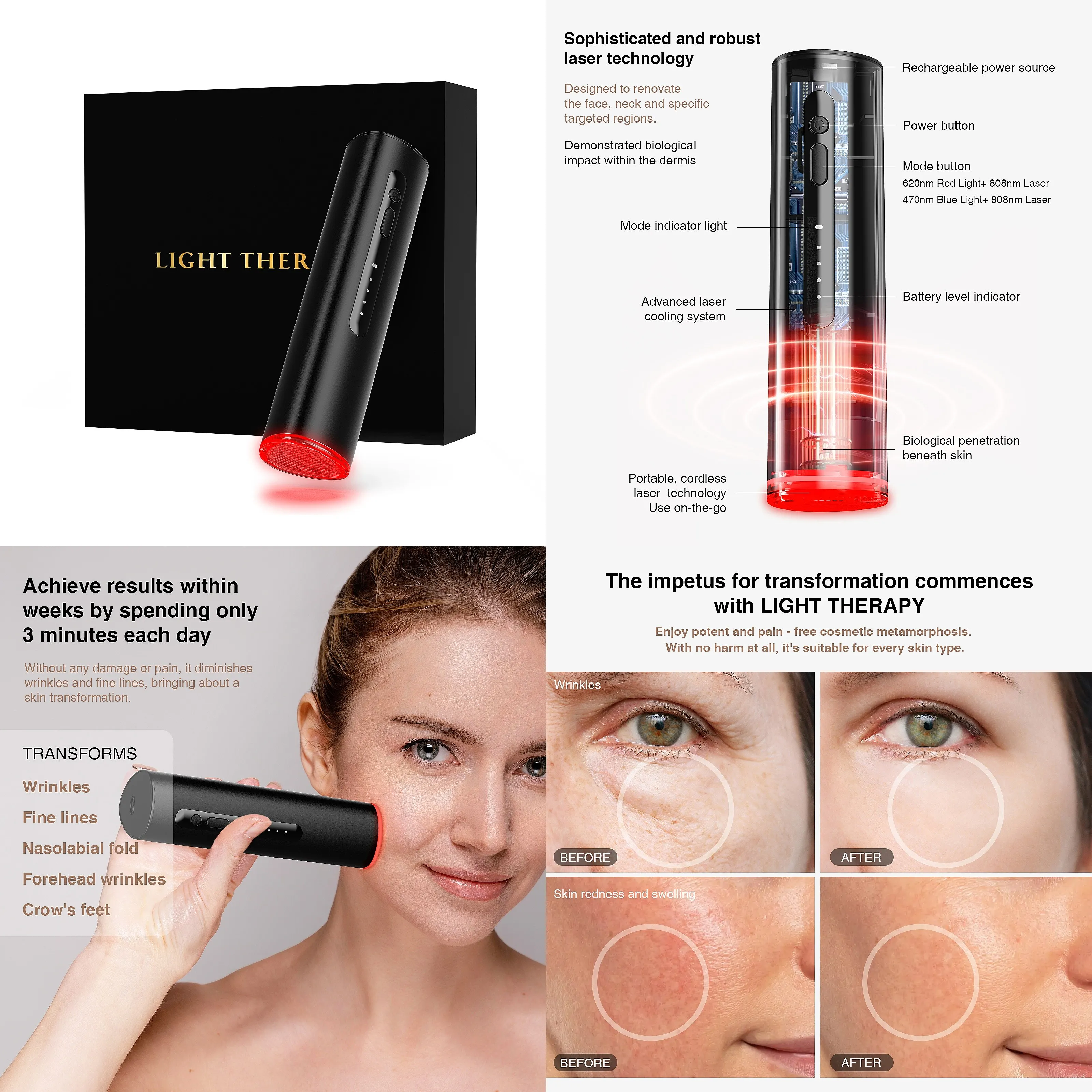 2026 New LED Infrared Red Light Therapy Wand Head 460nm 630nm 660nm 850nm 900nm Lasers Beauty Equipment