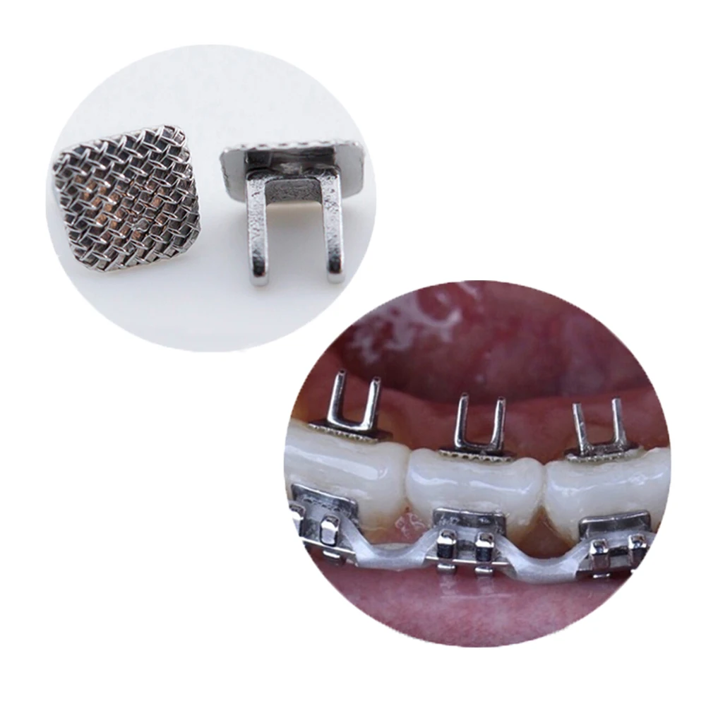 Zunge Tamers Biss Opener 10 teile/beutel Dental Kieferorthopädische Lingual Tasten Metall Bondable Mesh Basis Zahnmedizin Zubehör Materialien – Detail 6