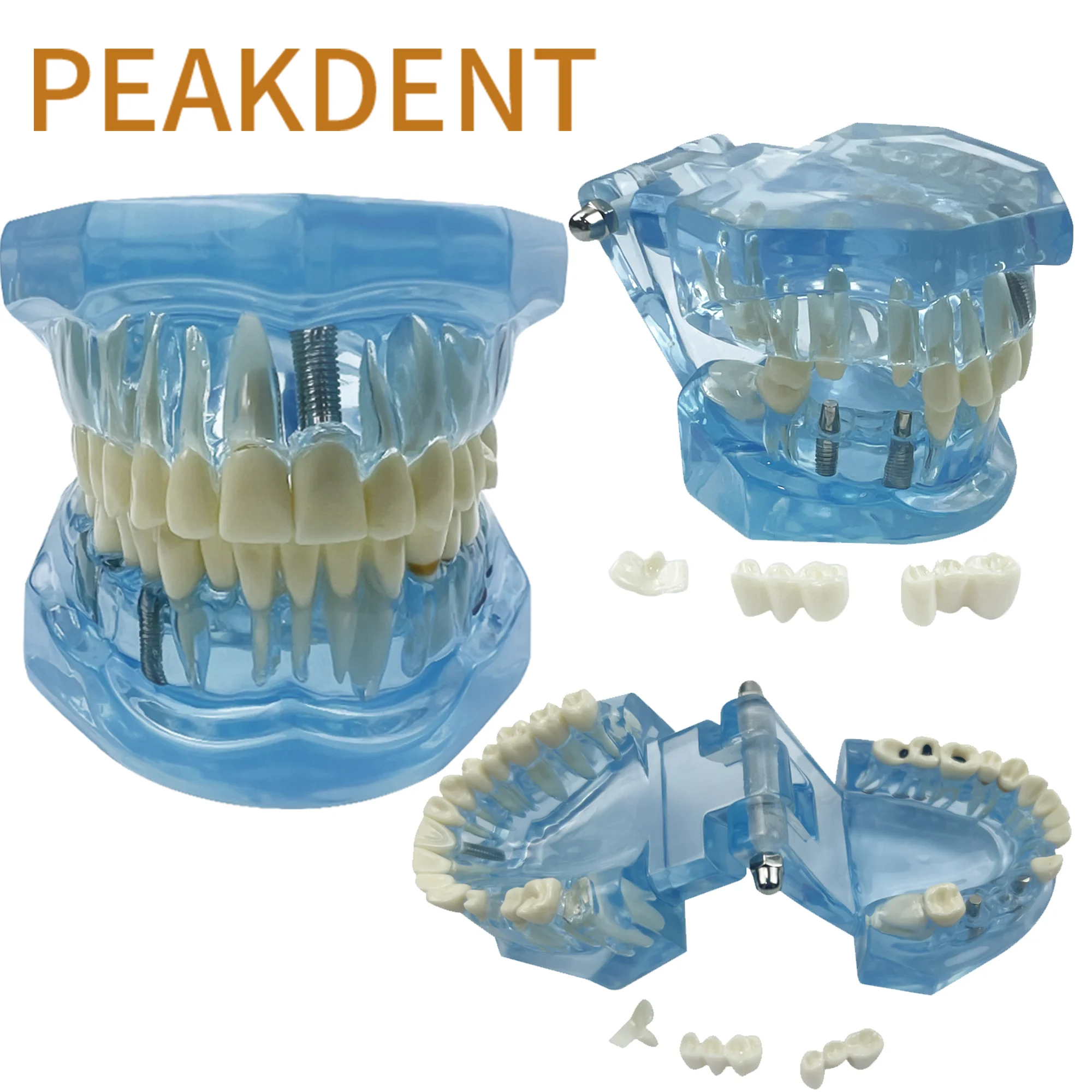 

Нормальная Стоматологическая модель зубов, зубная модель для обучения, прозрачная синяя стоматология, модель зубов для взрослых, тренировка, обучение, демонстрация полости рта