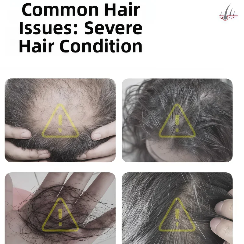 

LLLT 650 нм лазерный диодный шлем для роста волос лазерный колпачок для лечения выпадения волос