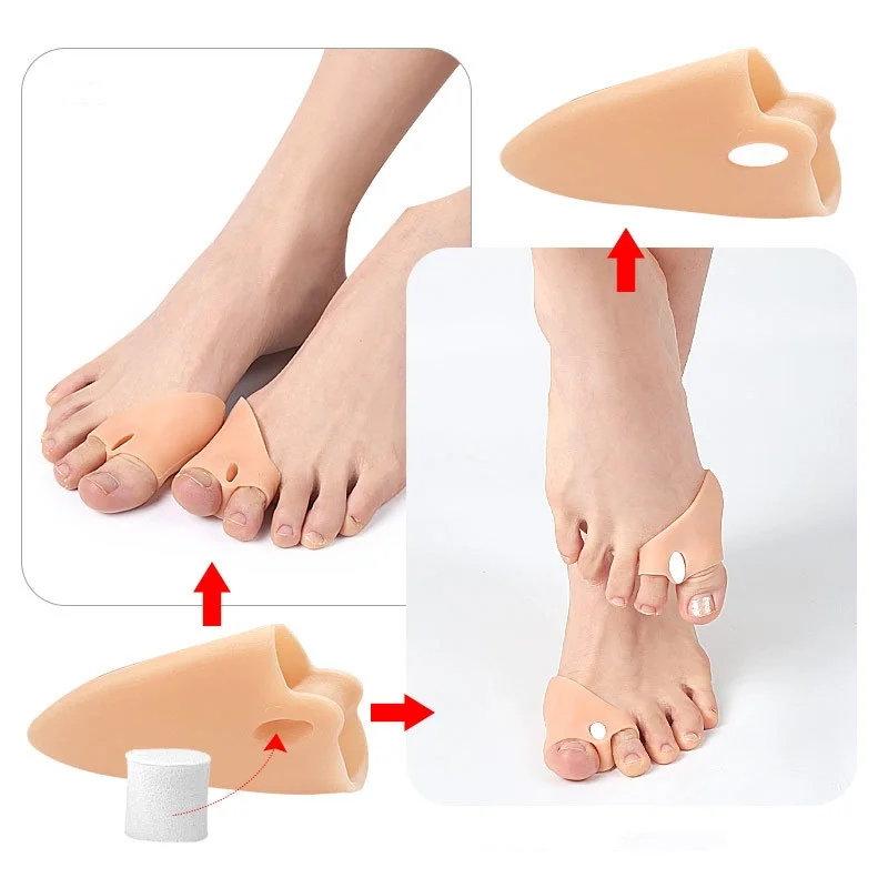 Sebs Forefoot Pad Toe Splitter Design Adjustable Force Hallux Valgus Size Toe Overlap Separator