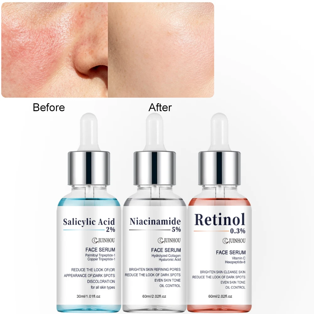 JUINHOU 3-teiliges Hautpflege-Serum Salicylsäure Niacinamid Retinol Aufhellend Porenverfeinernd Ölkontrolle Feuchtigkeitsspendend für Tägliche Hautpflege – Detail 11