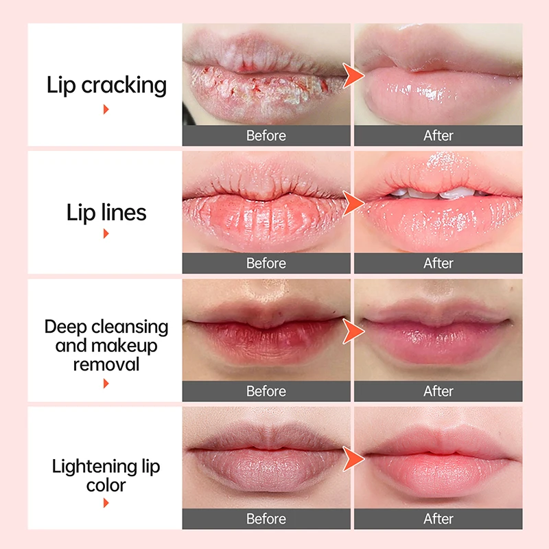 Bubble Lip Balm Exfoliating Mask Lightening Dark Whitening Moisturizing Remove Dead Skin for Women Volumizer Lip Care - Image 4