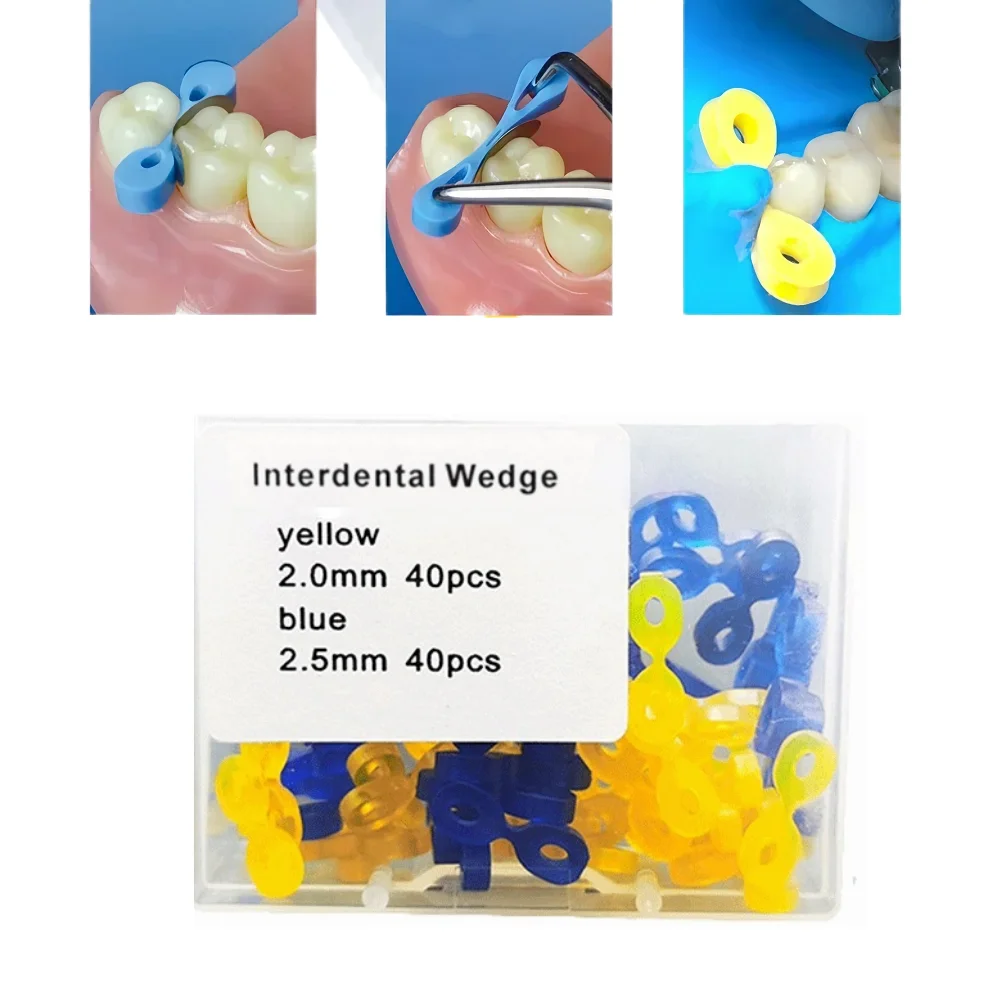 

80pcs/box Dental Elastic Rubber Fixing Wedges Matrix Matrices Dam Composite Dental Tooth Separator Tooth Separator Tool