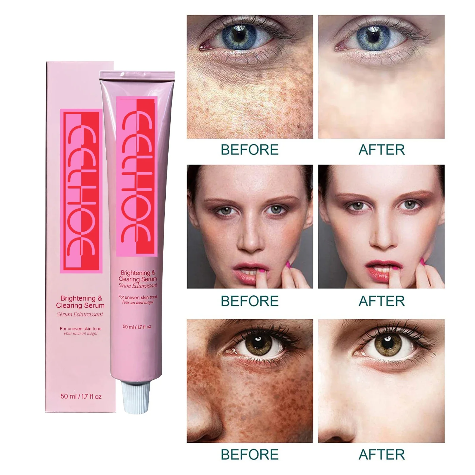 Effective Whitening Freckle Cream Fade Dark Spot whitening Essence Removal Melanin Melasma Lighten Brighten Smooth Skin Care