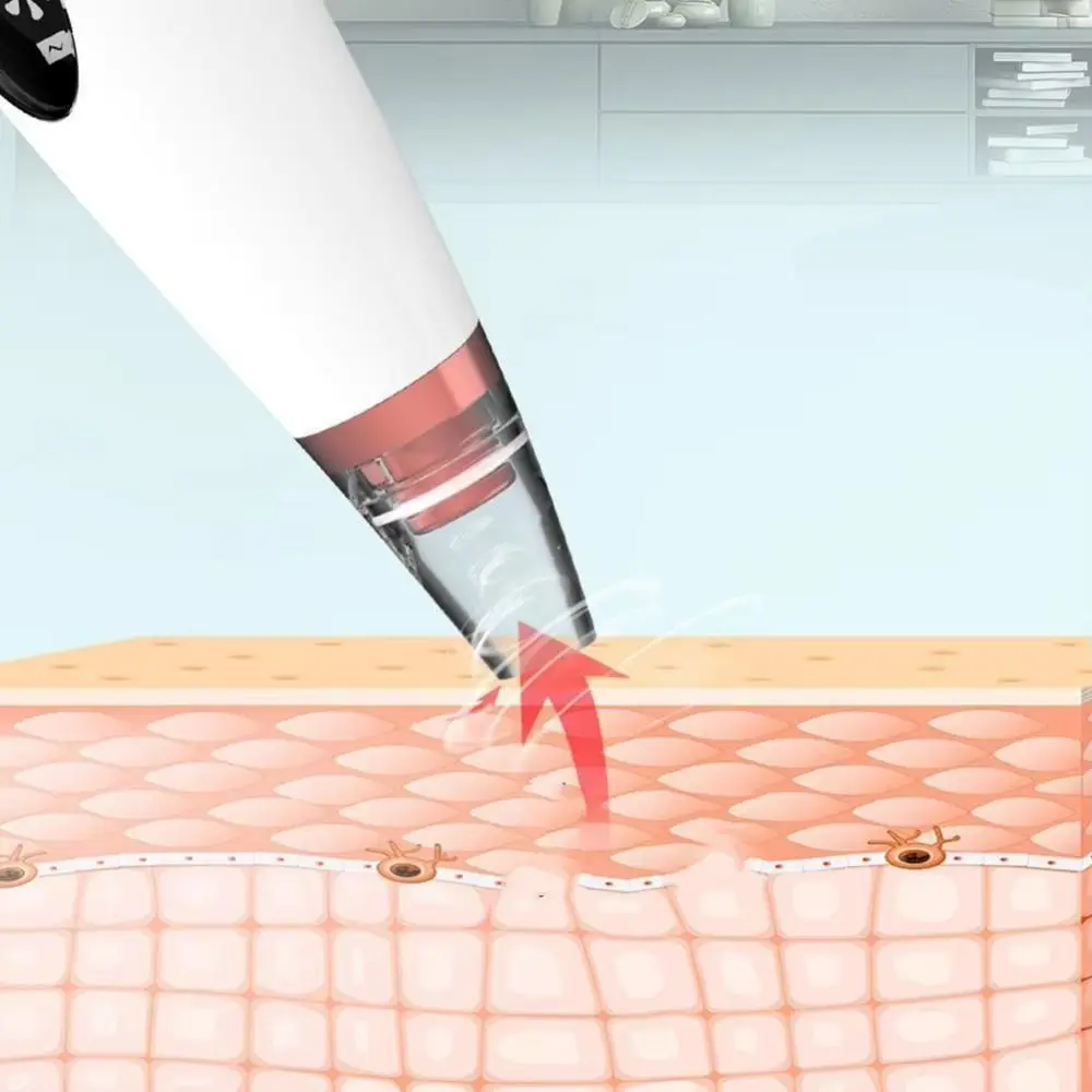 Strumento elettrico per la rimozione dei punti neri Ciclo dell'acqua Aspirazione sottovuoto Detergente per l'acne USB ricaricabile per la rimozione dei punti neri Detergente per i pori