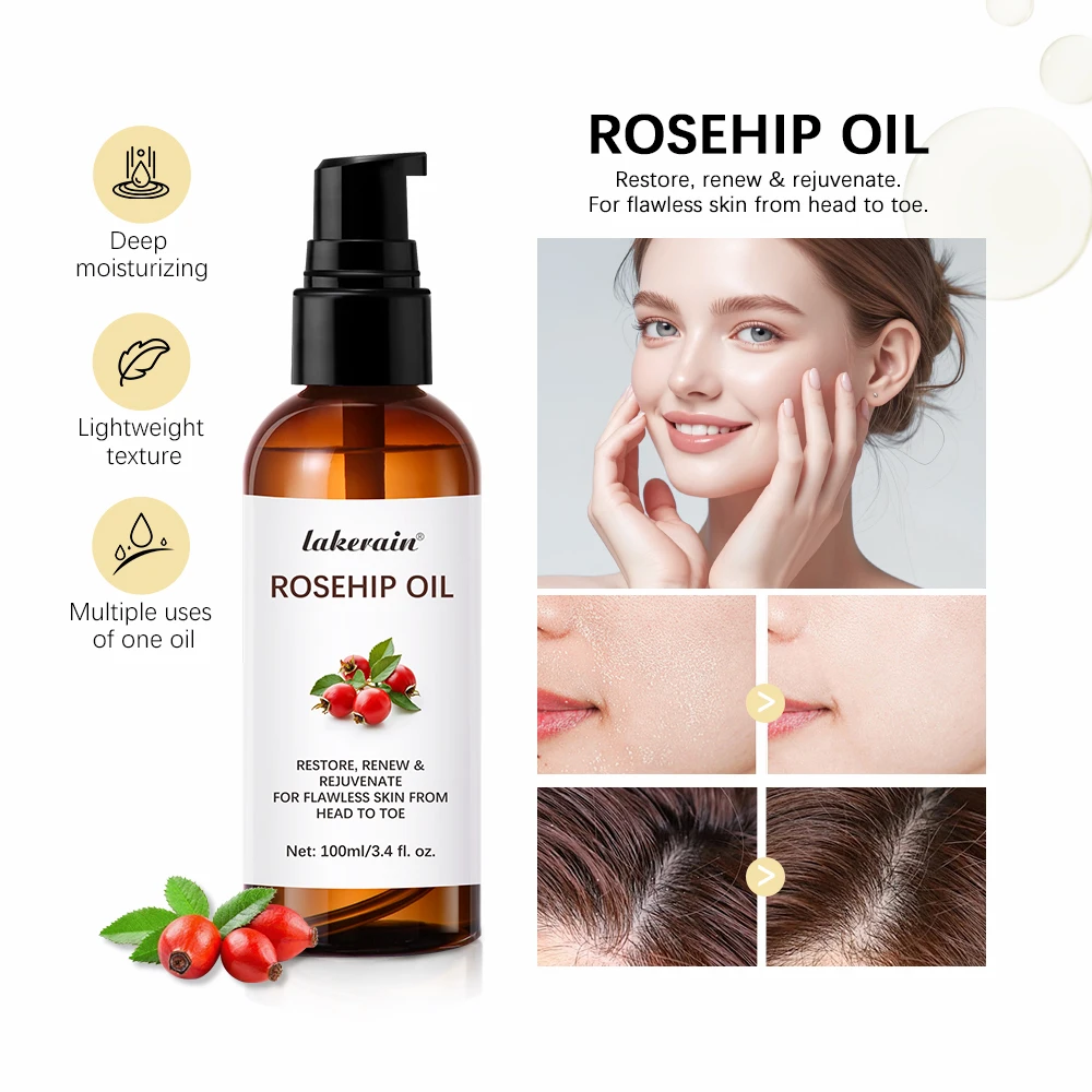 100ml Multifunction Moisturize Rosehip Essential Oil Anti Wrinkle Whitening Rose Essence Shrink Pore Face Serum Skin Care Oil