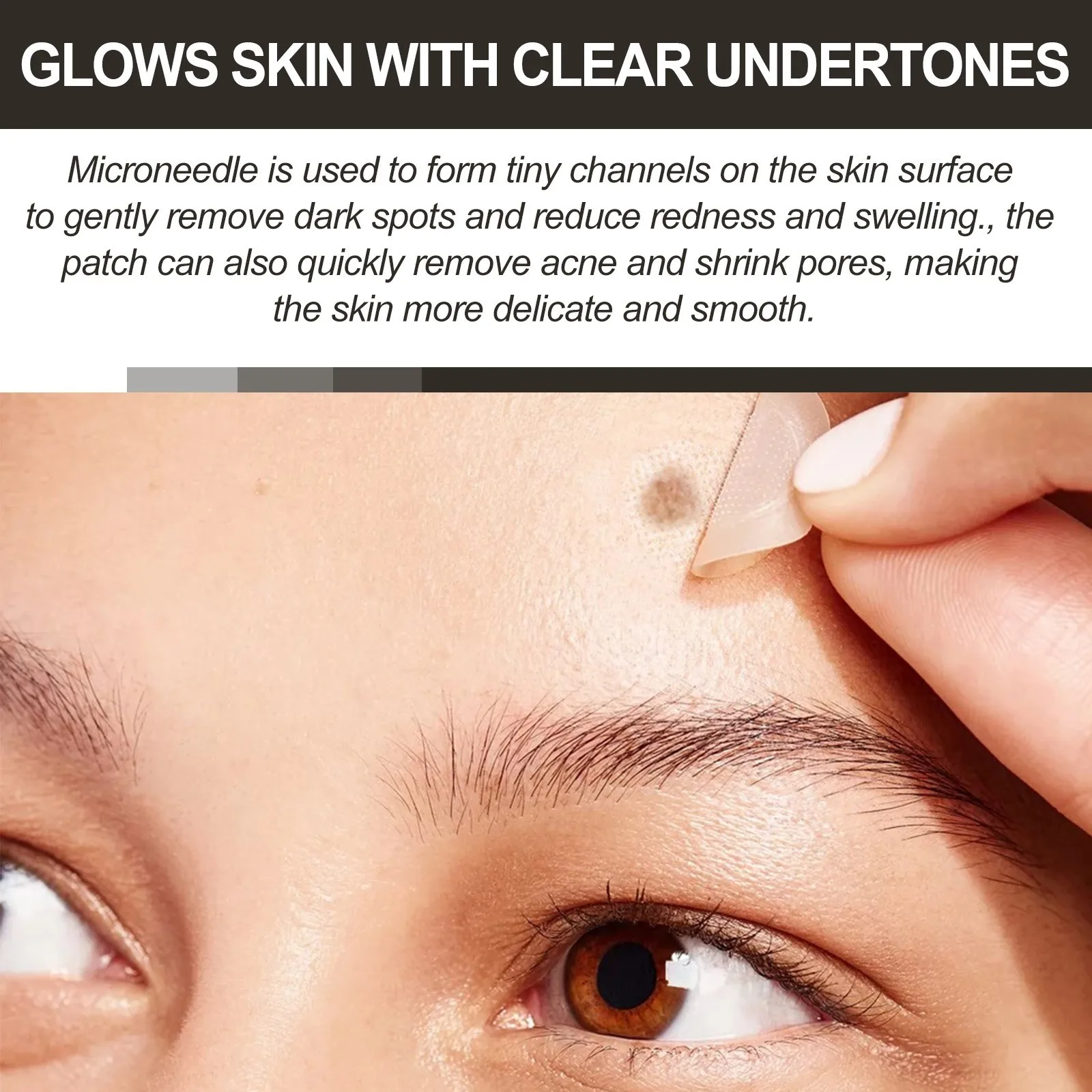 Parches faciales para espinillas, microagujas, parche de secado, pegatinas para cubrir, 72 unidades, cuidado absorbente durante todo el día