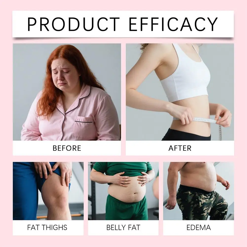 

Hot Assistive Care Patch Burns Gently And Has A Long-lasting Slimming Effect Making Beauty and Health Tools