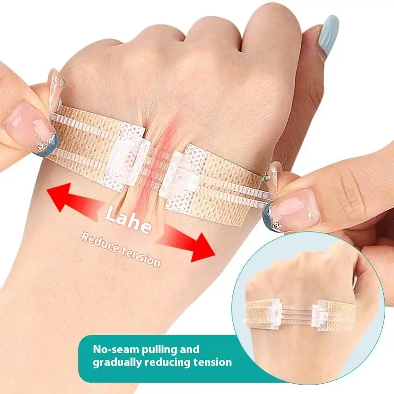 Zipper Tie Wound Closure Patch Hemostatic Patch Wound Fast Without Suture Zipper Outdoor Band-Aid Portable Quick Clot Wound
