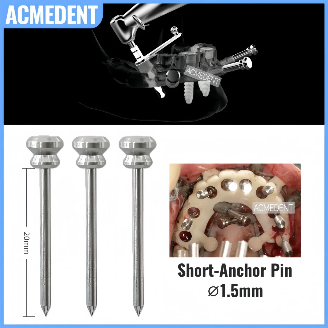 

⌀1.5 Dental DSG Fixation Pin Guided Anchor Pin Short For Implant Denture Fixed Digital Guide Plate Fits 3DDX Guided Kit