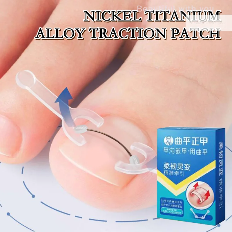 Ingrown Toenail Corrector Tools Pedicure Recover Embed Toe Nail Treatment Professional Ingrown Toenail Straightening Clip Brace