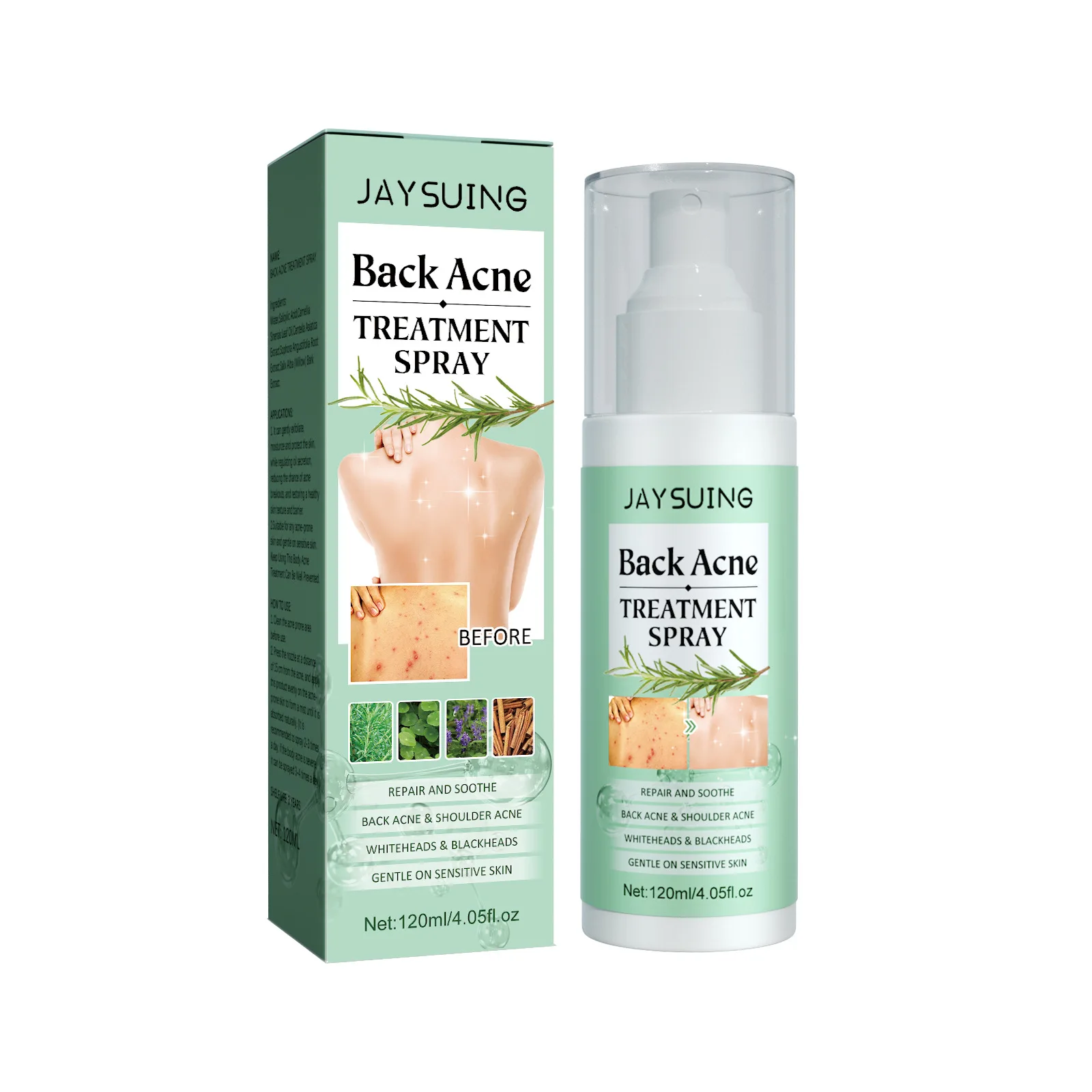 Back Acne Treatment Spray Salicylic Acid Fade Acne Mark Repair Pimple Spot Shrink Pore Moisturizing Soothe Body W-hitening Serum