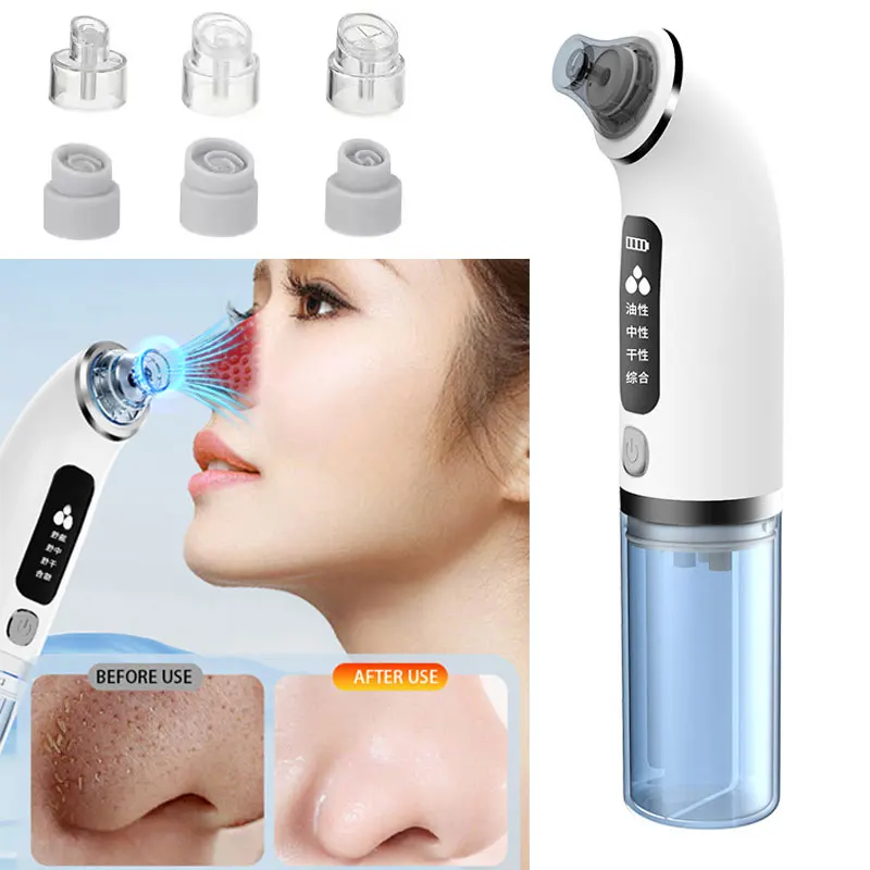 顔の黒ずみ除去器 毛穴クリーナー エクストラクター ニキビ治療 黒ずみ除去真空機