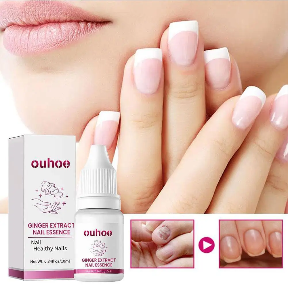 OUHOE 10ml Ginger Nail Essence Nourishing Rough Nails Anti Paronychia Nail Fungal Nail Treatment Essence Hand Foot Care