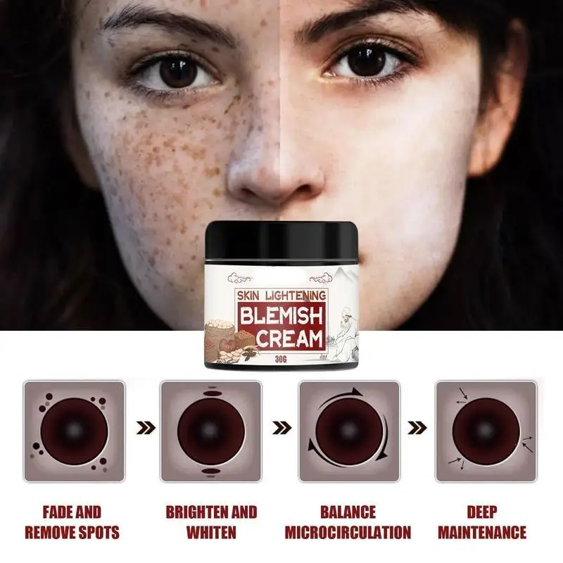 Become Beauty Ginseng Extract Whitening Cream Remove Freckles Whitening Freckle Spots Cream