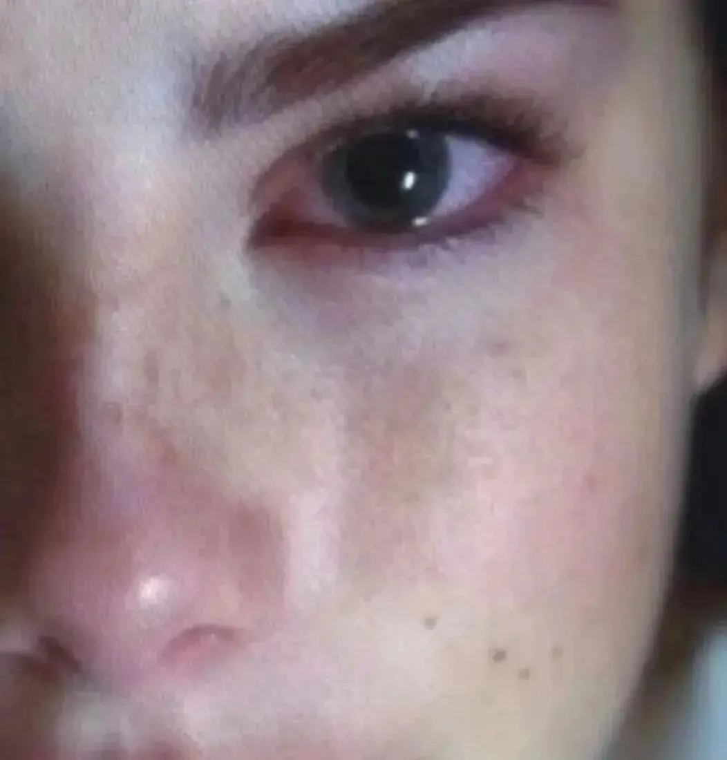 Gotas para ojos de gato para perros, 2 uds., oftálmicas refrescantes para ojos secos, eliminador de manchas en forma de lágrima para mascotas, lubricante para ojos