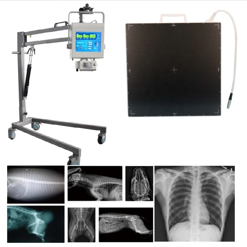 X- Ray Digital Portable X-Ray Machine With DR Panel For Radiography Imaging Diagnosis Digit Xray Detector