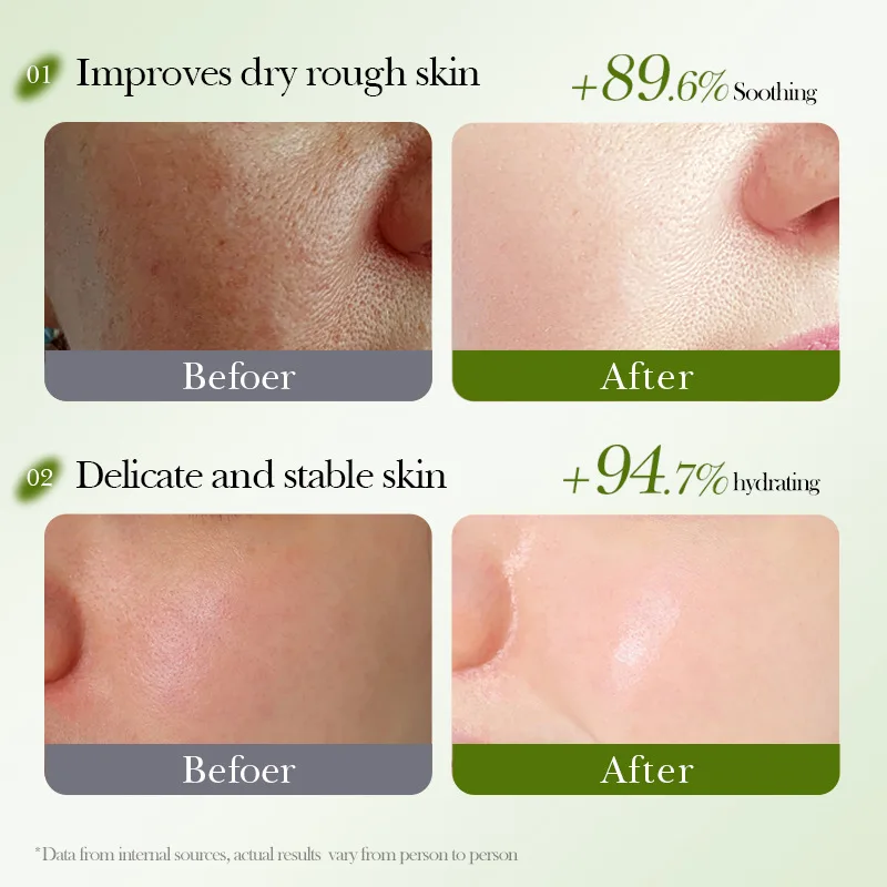 10 عبوات من قناع ترطيب الأفوكادو 2025 - للبشرة الواضحة والناعمة والرطوبة العميقة #5