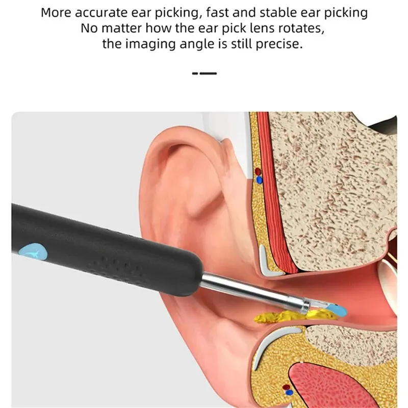 Smart Ear Cleaner Upgrade Waterproof & Dustproof w/ HD Camera - Wireless Visual Otoscope for Ear Wax Removal and Oral Inspection