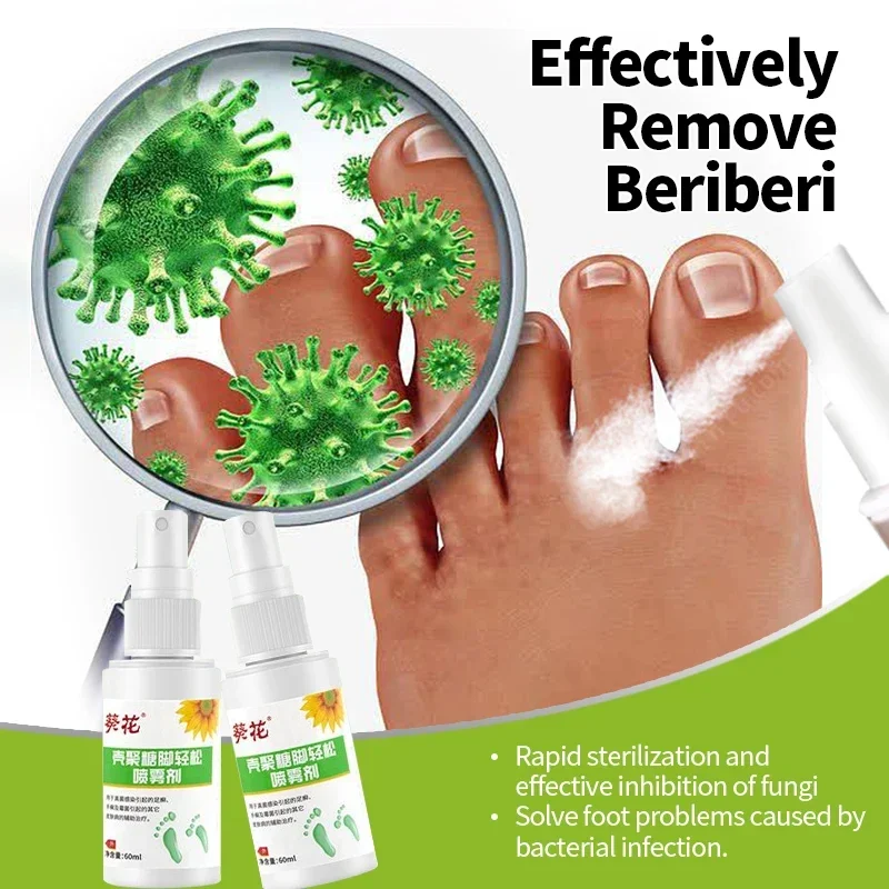 Foot Odor Tinea Pedis Treatment Spray Remover Feet Sweat Beriberi Athlete Foot Peeling Anti Fungal Itch Inhibits Fungus Medicine