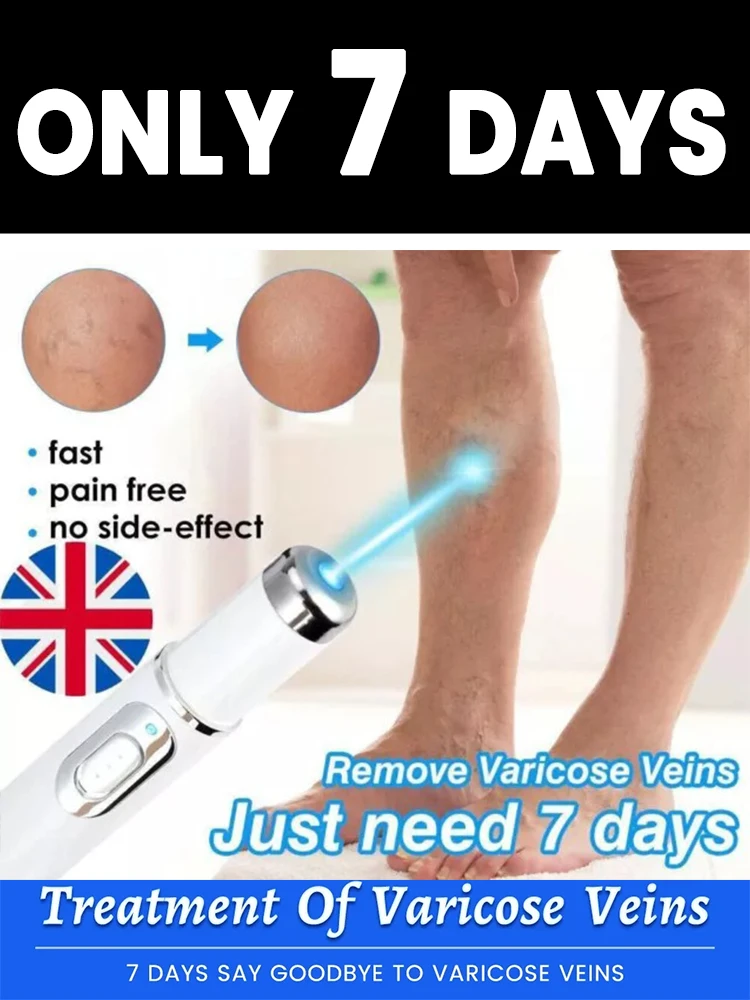 

Generation-1 Laser Says Goodbye To Spider Legs Varicose In 1 Week