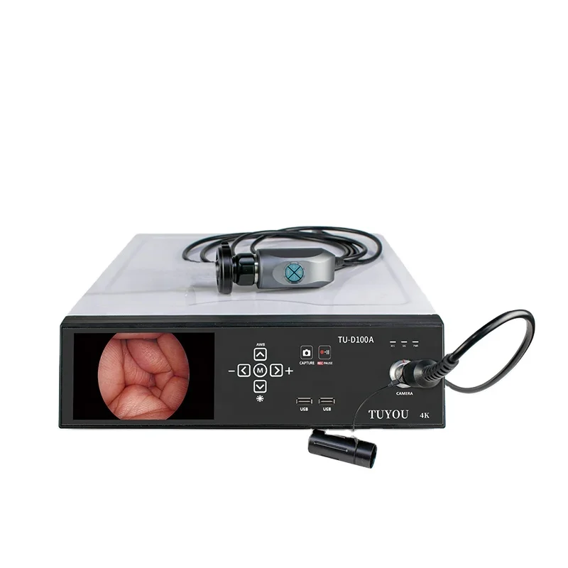 Tuyou Full HD 1080P U disk Video Recording Medical Endoscope Equipment