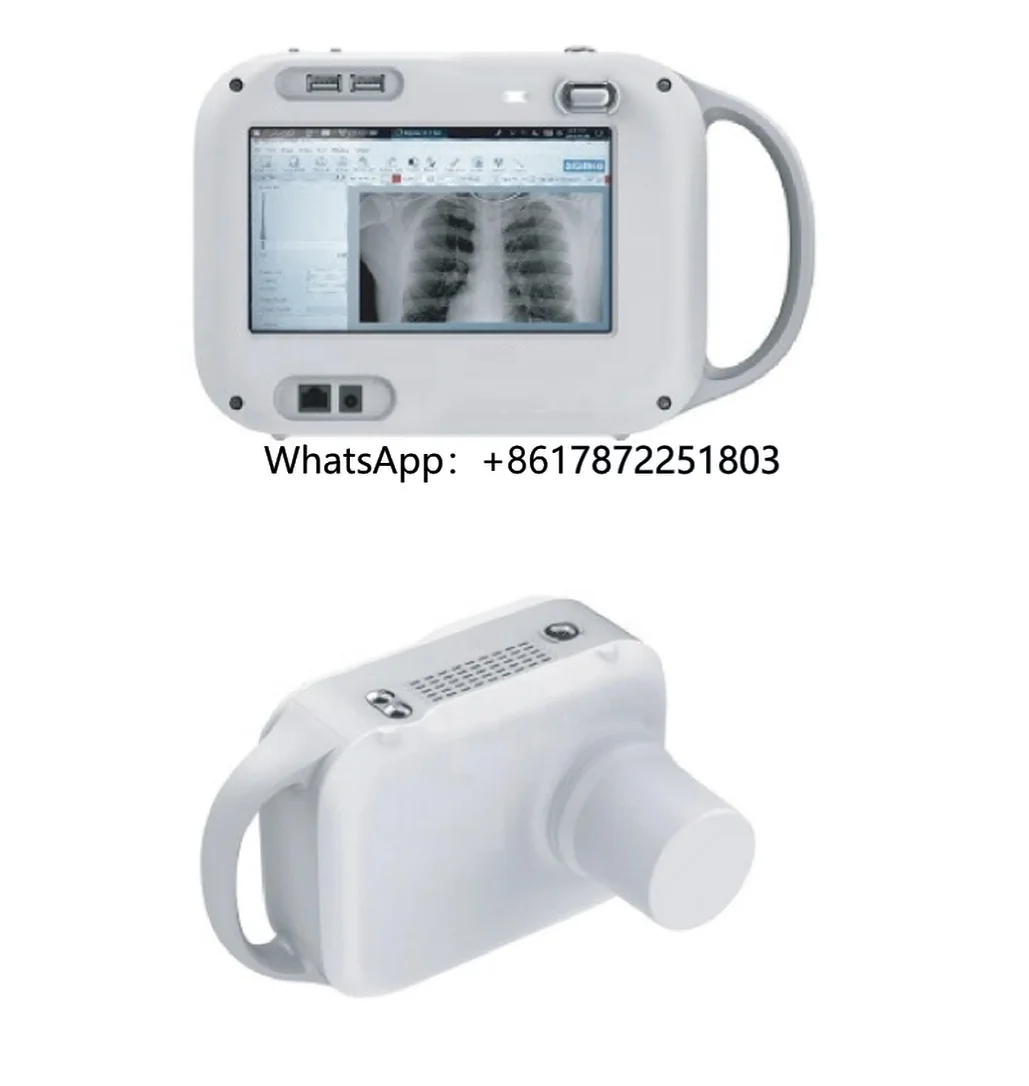 Medical High Frequency X-ray Radiography System Handheld X Ray Portable Xray Machine Medical X-Ray