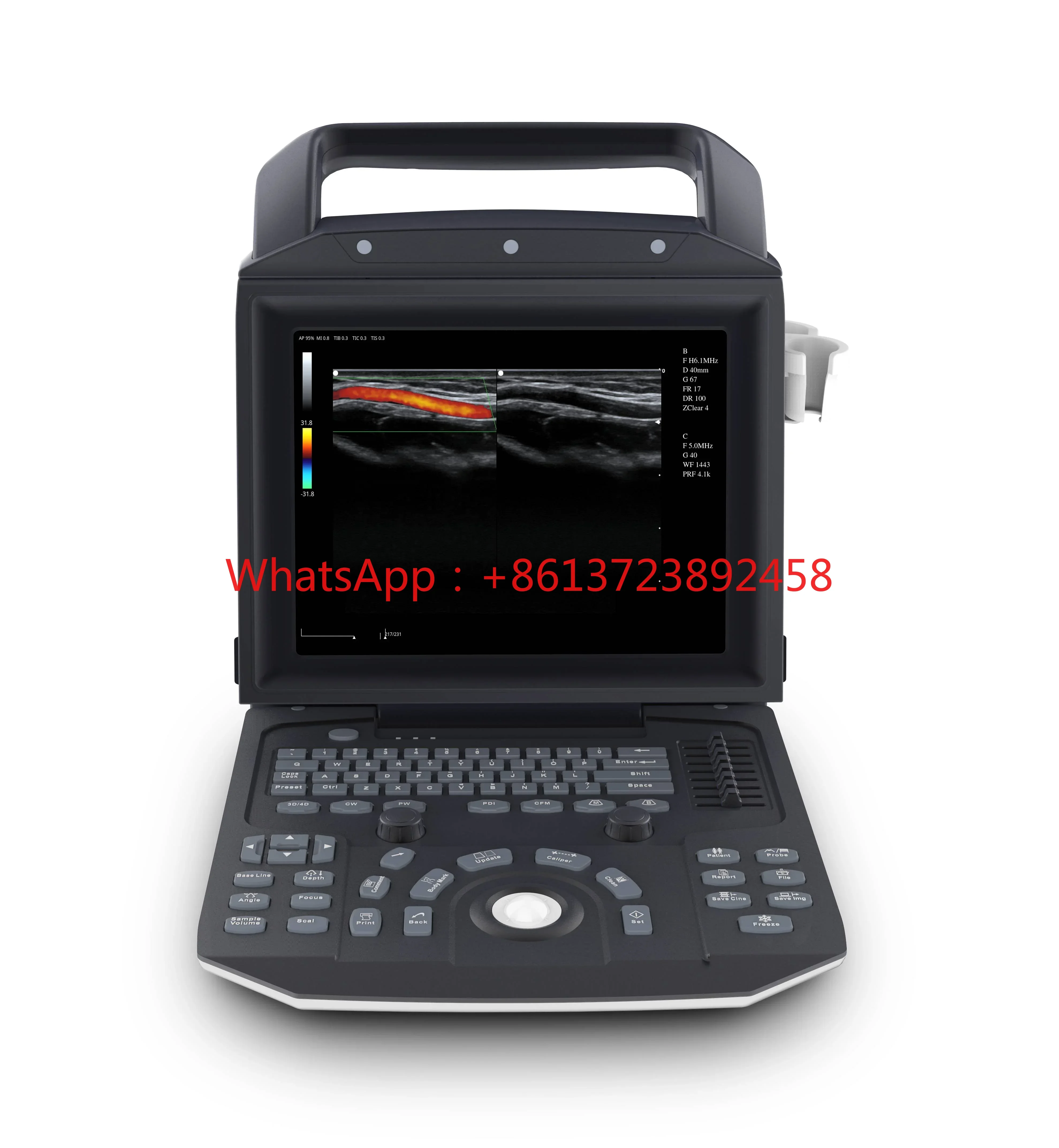 

YSB-M5 VET Ysenmed Veterinary Ultrasound Color Doppler Scanner Machine Portable Cow Pig Animal Ultrasound Machine Pet Ultrasound