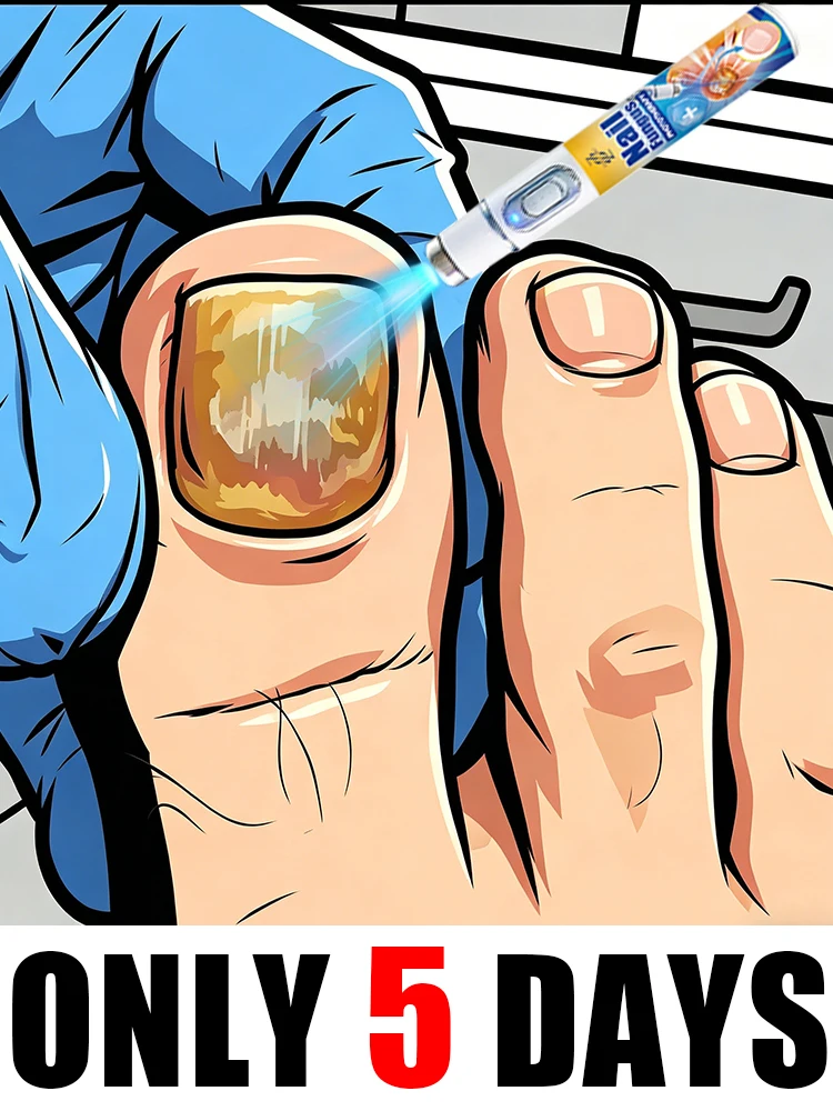 

2026 New Portable Blue Light Laser Pen for Foot Home Use Suitable for Both Men and Women .