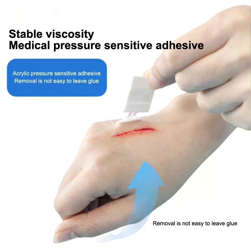 Medical Elastic Strap Zipper Tie Wound Closure Patch Adhesive Tape Wound Fast Without Suture Zipper Tape Skin Wound Dressing