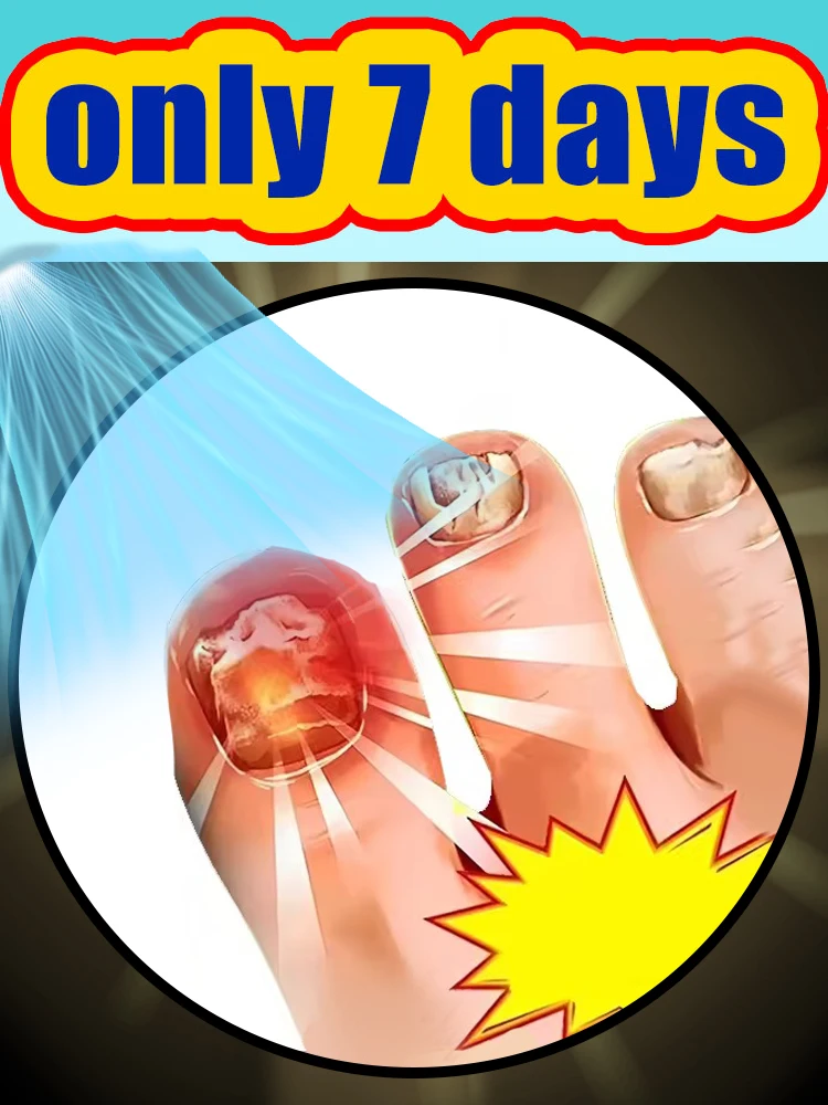 

2025 hot cleaning NEW nail brush tools, plastic vacuum cleaners, Say goodbye to nail troubles,Generation-2,Combination Set Meal