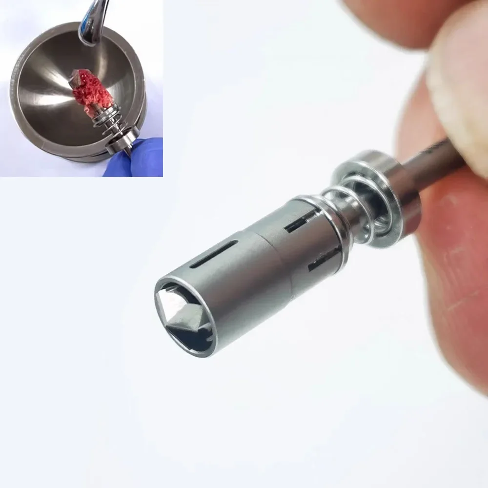 1Pc Dental Implant Spring Bone Harvesting Drill Self-Grinding Bone Extraction Drill Dental Implant Collection Bone Scrap Drill