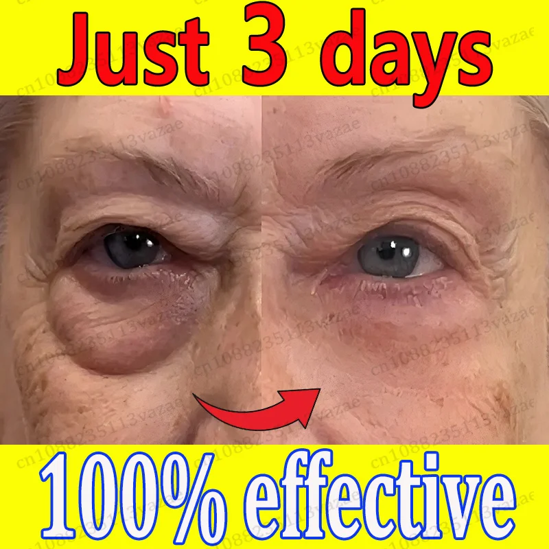 

No more worries about eye area problems
