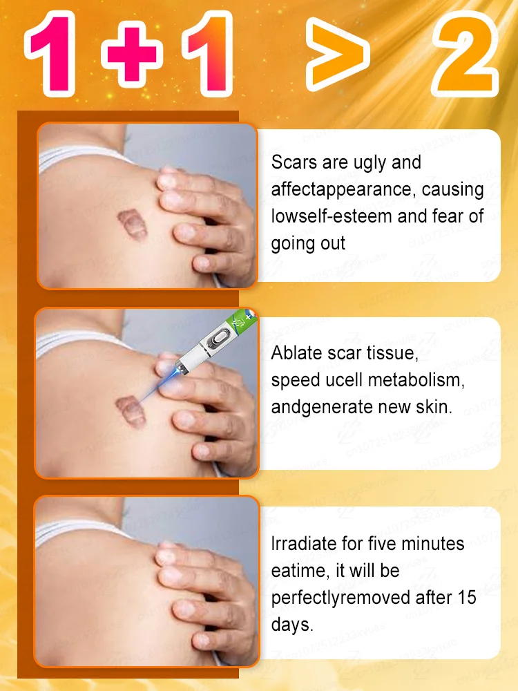 Qᴜɪᴄᴋʟʏ ʀᴇᴘᴀɪʀ sᴄᴀʀs, ʀᴇᴍᴏᴠᴇ ᴘɪɢᴍᴇɴᴛᴀᴛɪᴏɴ, ᴘᴏʀᴛᴀʙʟᴇ sᴄᴀʀ ʀᴇᴍᴏᴠᴀʟ ʟᴀsᴇʀ ᴘᴇɴ, ʀᴇᴘᴀɪʀ sᴄᴀʀs ᴀᴛ ᴀɴʏ ᴛɪᴍᴇ