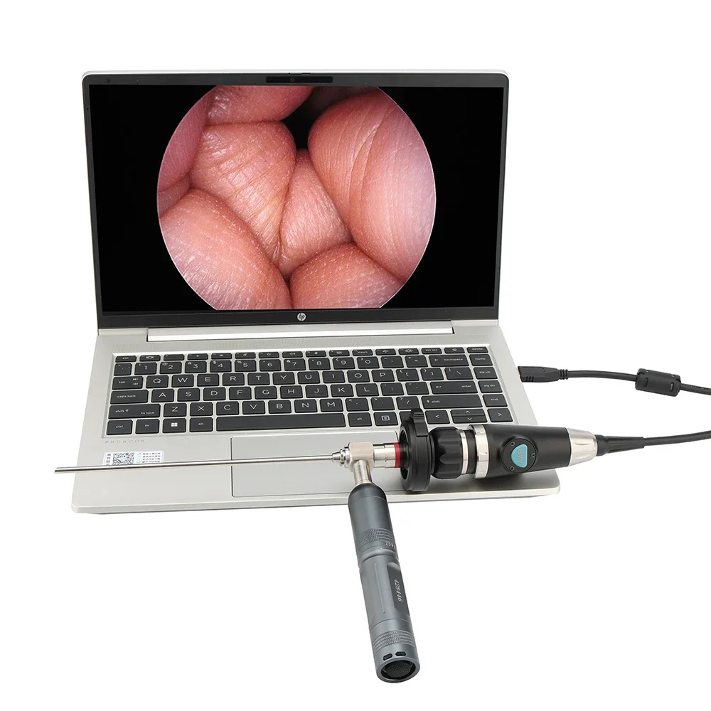 Hot sales endoscope camera portable, USB endoscope medical camera for for Laptop, Phone, ENT Video Endoscopy