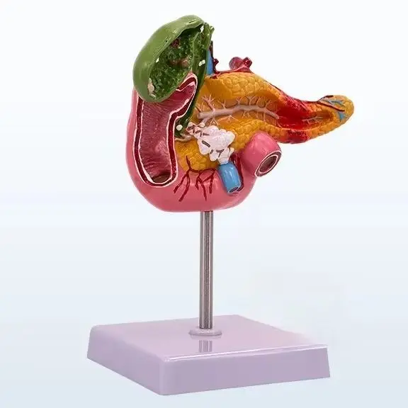 Teaching Simulation Human Pancreas Duodenal Gallbladder Pathological Model Gallstone Surgery Digestive System Teaching Aids