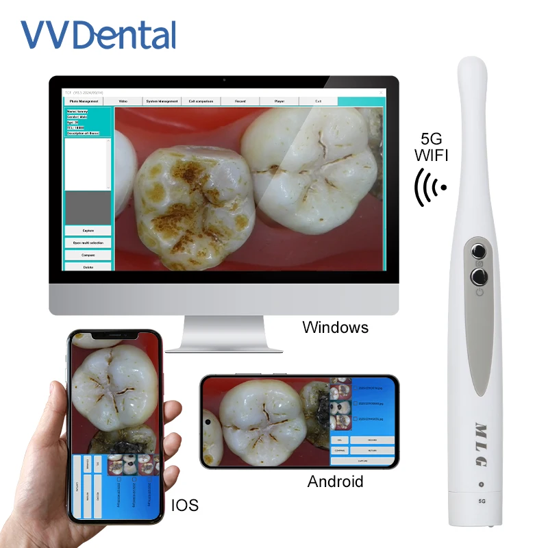 VVDental Wireless 5G Wifi Intraoral Camera USB Endoscope 1300W Pixels 8 LED Lights Waterproof Dentistry Observation Device