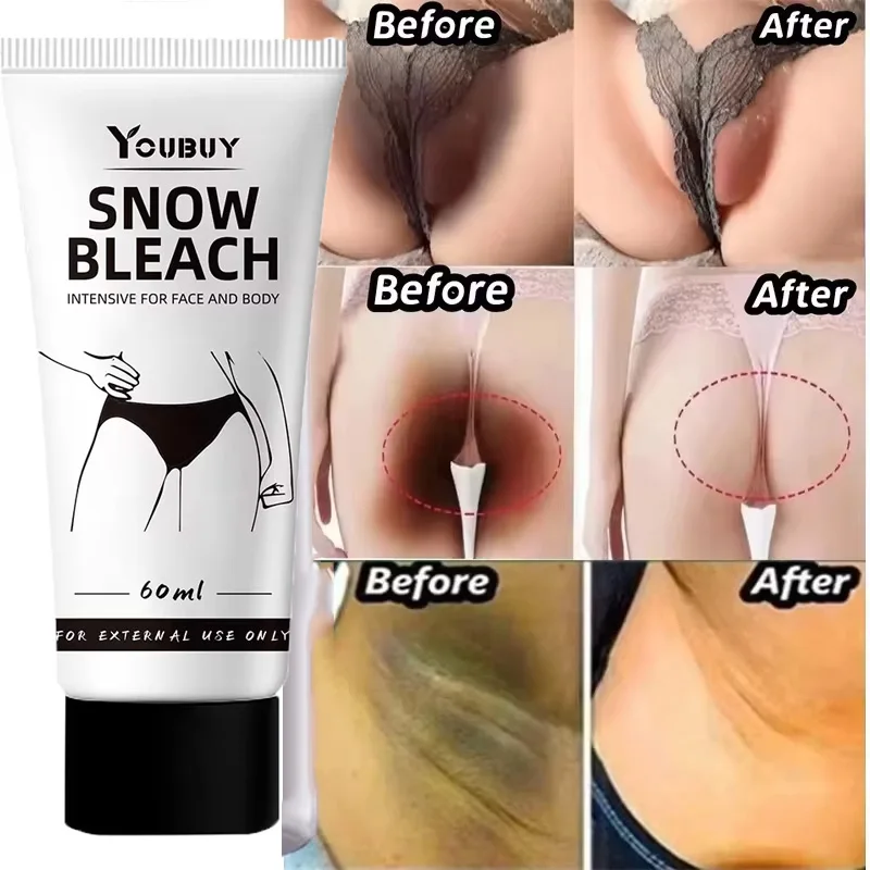 

Whitening Cream Private Parts Underarm Bleaching Serum Whiten Butt Knee Brighten Inner Thigh Intimate Parts Dark Remove Melanin