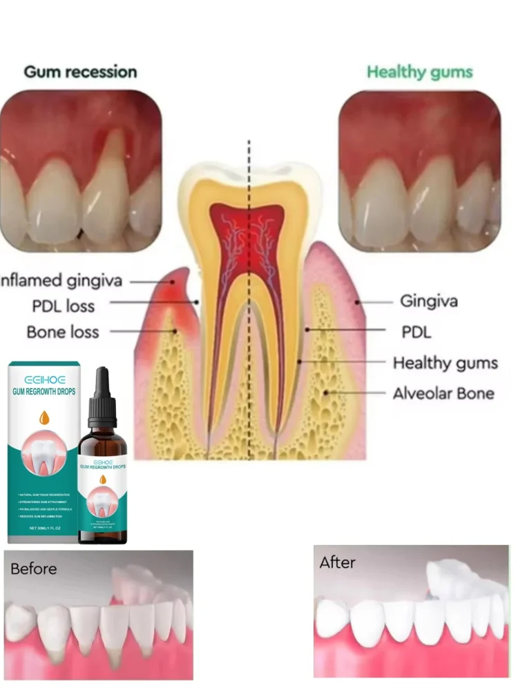 Gum Repair Drops Relieve Receding Gingival Swelling Gum Cleaning Care Oral Periodontal Hygiene Remove Stain Remove Yellow Tartar