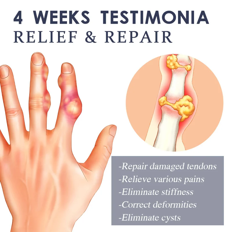 علكات وكبسولات فيتامين الناعمة توفر الرطوبة ويغذي العناية بالأعصاب وتحسين النوم وتعزيز الراحة الليلية #3