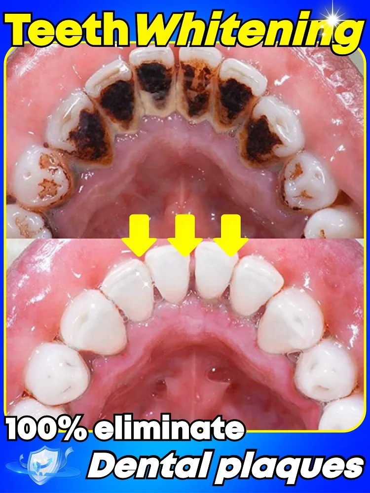 2025 latest development of new technology mineral powder for effective whitening and plaque cleaning